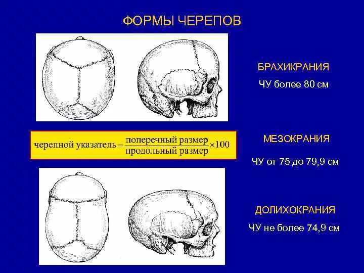 Варианты формы черепа. Формы черепа долихокрания. Мезокранная форма черепа. Правильная форма черепа. Форма черепной коробки.