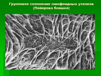 Пейеров бляшки