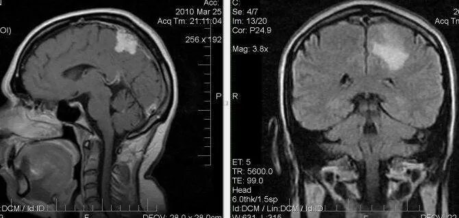 Чем отличается узи от мрт. Кт и мрт снимок разница. Кт мрт рентген в чем разница. Отличие рентгена от кт и мрт. Мрт и рентген разница.