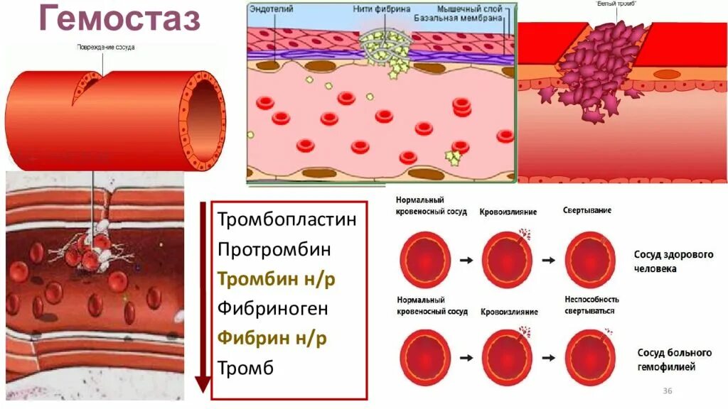 Как изменится количество фибрина после пореза. Протромбин тромбин фибриноген фибрин тромб. Гемостаз крови. Гемостаз презентация. Гемостаз картинки.