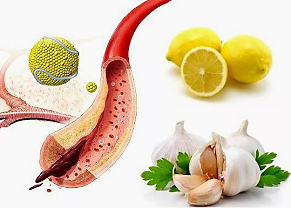 Какие народные средства от холестерина