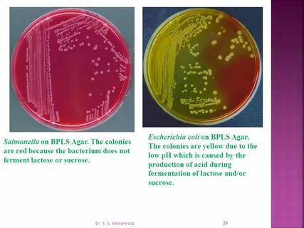 Escherichia coli в моче