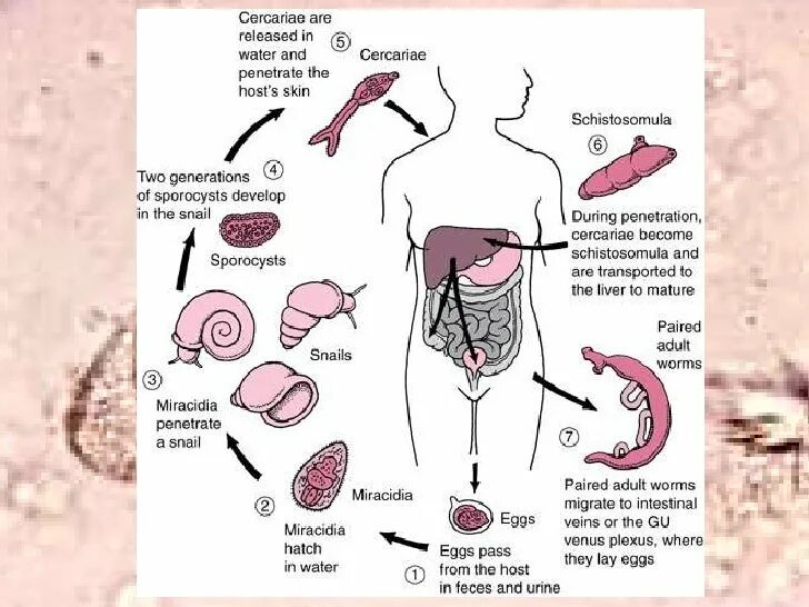 Жизненный цикл шистосом. Schistosoma жизненный цикл. Жизненный цикл шистосом схема. Шистосома кровяная жизненный цикл.