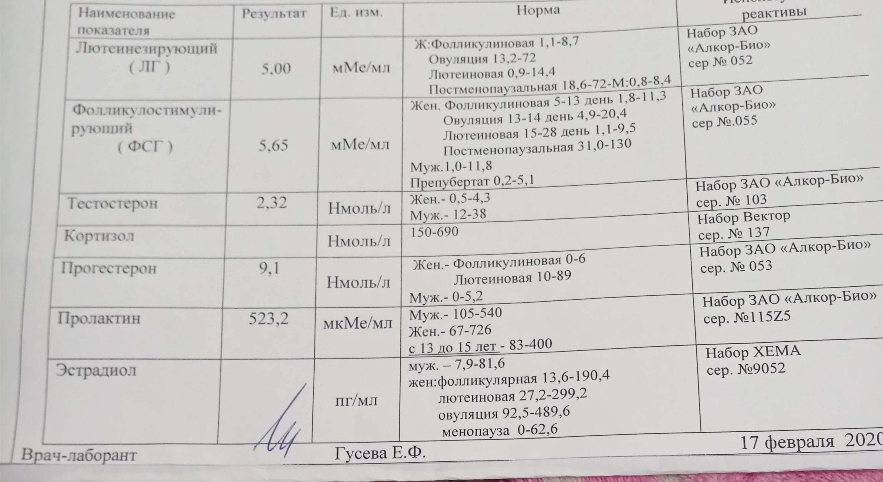 Прогестерон 21 нмоль/л. Прогестерон на 21 день цикла норма нмоль/л. Норма 17 он прогестерона в нмоль. 17-Он-прогестерон норма у женщин нмоль/л. Пролактин овуляция