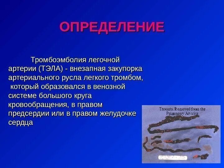 Тромбоэмболия легочной артерии. Тэла определение. Тромбоэмболия это определение. Тромбоэмболия ствола легочной артерии ведет. Оторвался тромб в легких