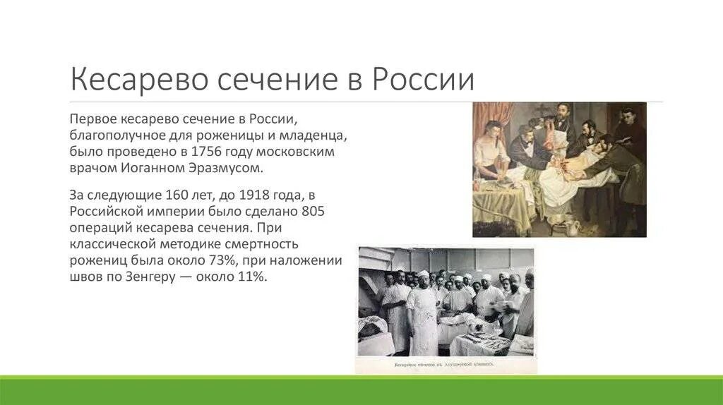 История кесарева сечения. Кесарево сечение в России. История операции кесарево сечение. Первая операция кесарево сечение история. Половой акт после операции