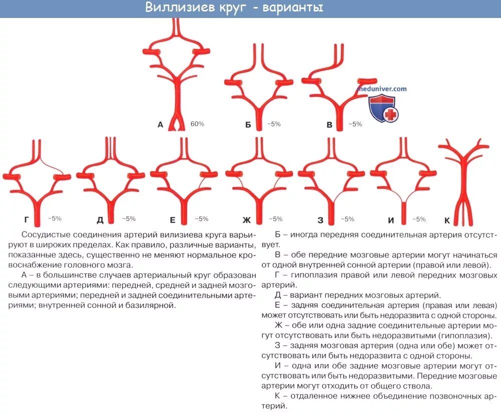 Развитие виллизиева круга в виде отсутствия кровотока. Сегменты артерий Виллизиева круга. Артерии Виллизиева круга анатомия. Кровоснабжение головного мозга, Виллизиева круга. Трифуркация левой внутренней сонной артерии на кт.