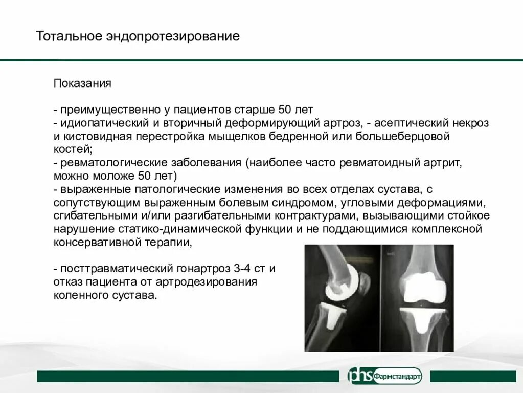 Квота на операцию коленного сустава как получить. Эндопротез тазобедренного сустава рентген протокол. эндопротез коленного сустава рентген протокол. эндопротез коленного сустава рентген заключение. эндопротез тазобедренного сустава кт.