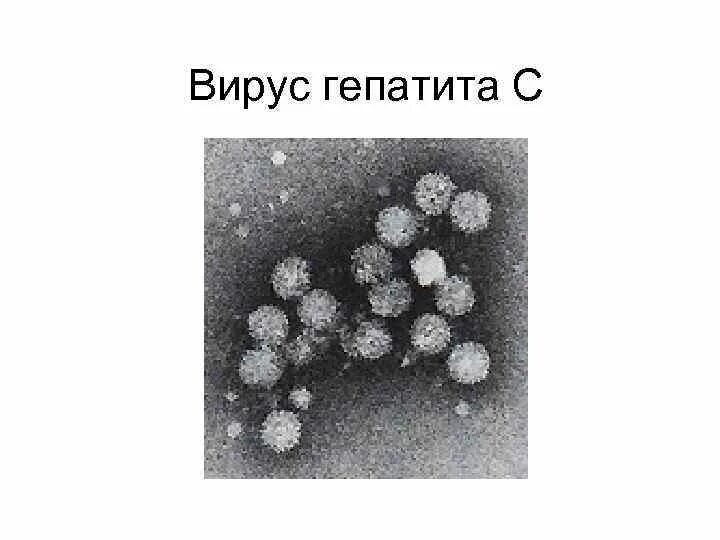 Гепатит а микробиология. Вирус гепатита в. вирус гепатита с возбудитель. вирус гепатита а микробиология. вирус гепатита под микроскопом.