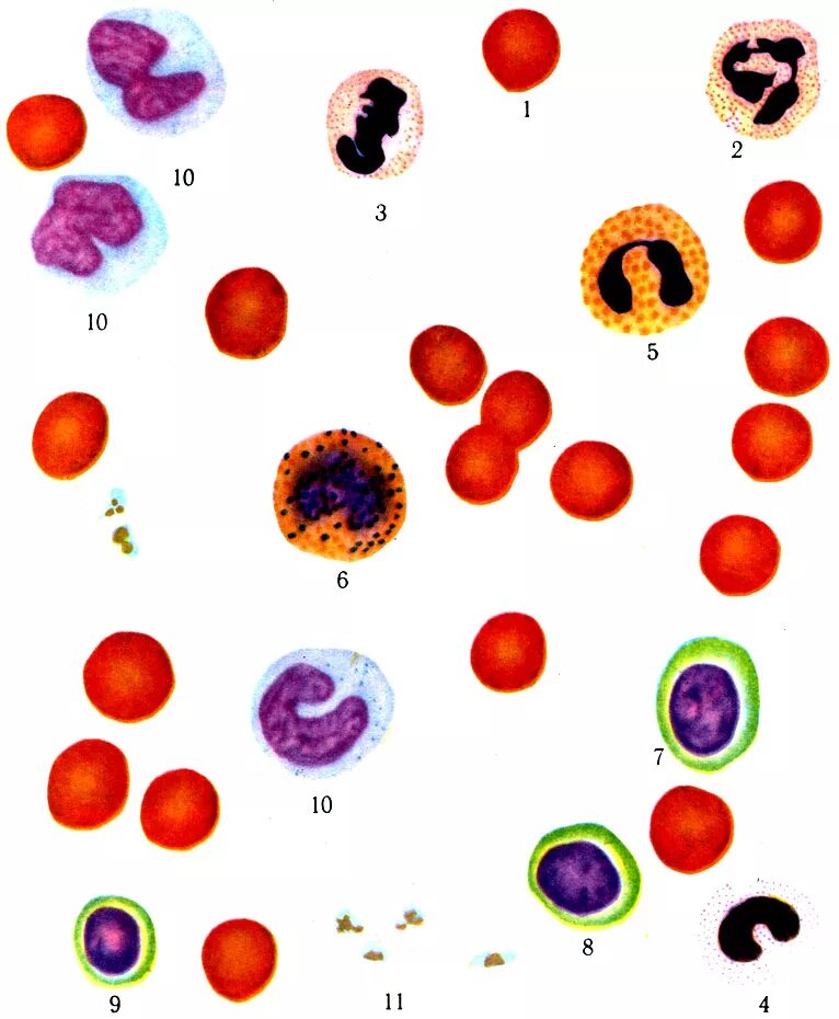 Мазок крови схема. Лейкоциты. Юные элементы крови. Патологические элементы крови с названием.