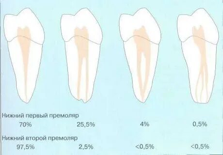 Верхний 5 зуб канал