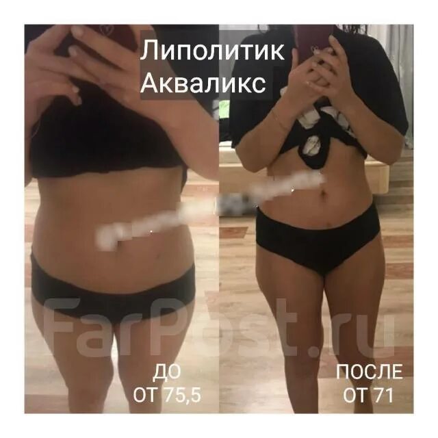 Липолитики. АКЦИЯ!!! ЖИВОТ 2000, подбородок 1000руб 2023 Елена Серова ВКонтакте