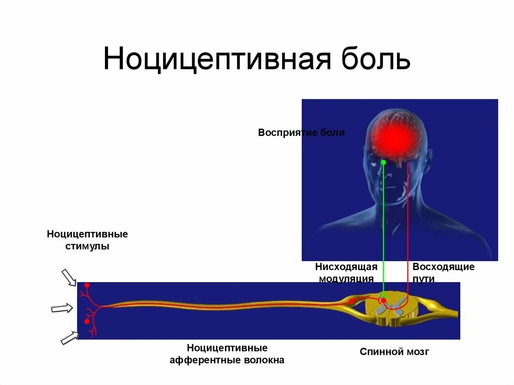 Болезненно воспринял. Ноцицептивная боль. Ноцицептивная система боли. Ноцицептивные волокна. Ноцицептивная боль возникает при.