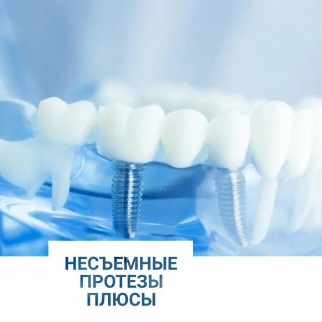 протезирование отзывы вологда