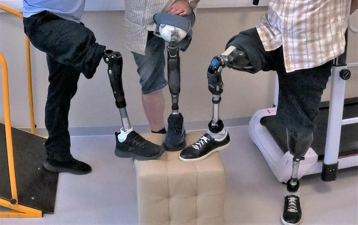 Инвалиды сво 1 группы. Протез ноги. Протез голени. Ножные протезы для инвалидов.