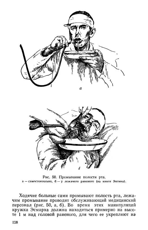 Полоскание рта пациента. Промывание ротовой полости. Промывание полости рта пациенту. Кружка Эсмарха промывание рта. Болезни ротовой полости книга.