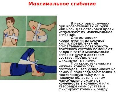 Брюшное кровотечение