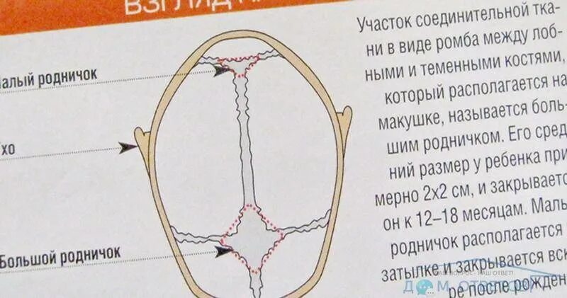 До какого возраста родничок. Родничок у новорожденных норма в 2 месяца на грудном. Родничок у новорожденных норма в 3 месяца на грудном. Размер родничка в 2 месяца норма таблица. Родничок у новорожденных норма в 8 месяцев.