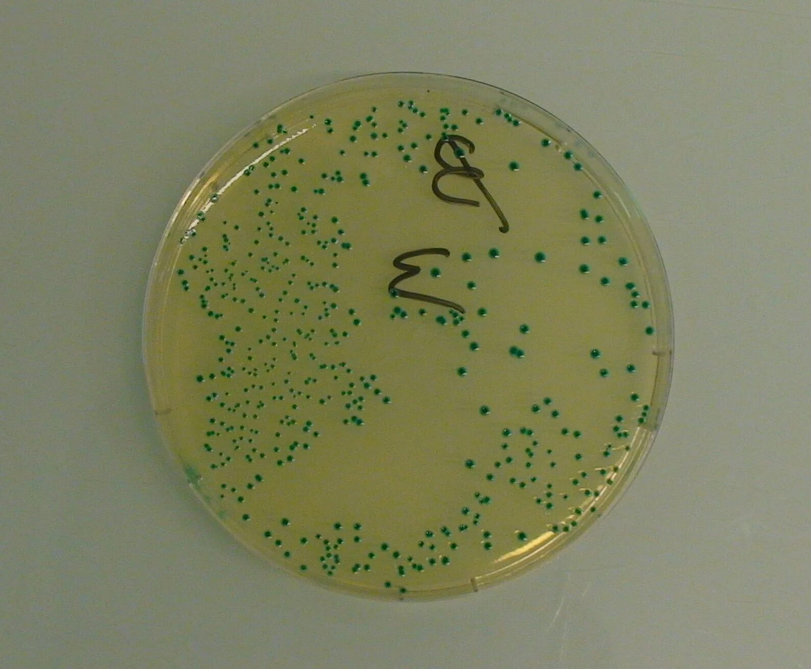 Pseudomonas aeruginosa на чашке Петри. Pseudomonas aeruginosa колонии. Синегнойная палочка микробиология. Pseudomonas aeruginosa микробиология. Синегнойная палочка возбудитель