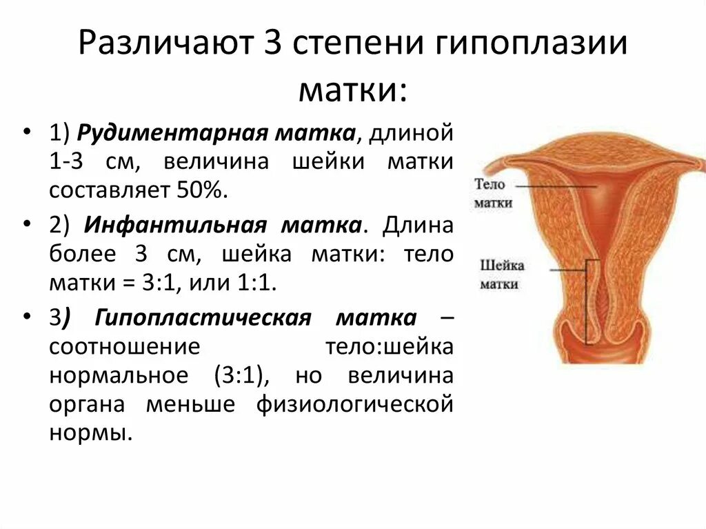 Гипоплазия эндометрии лечение. Гипоплазия тела матки 1 степени. Гипоплазия матки классификация по УЗИ. Степени гипоплазии эндометрия.