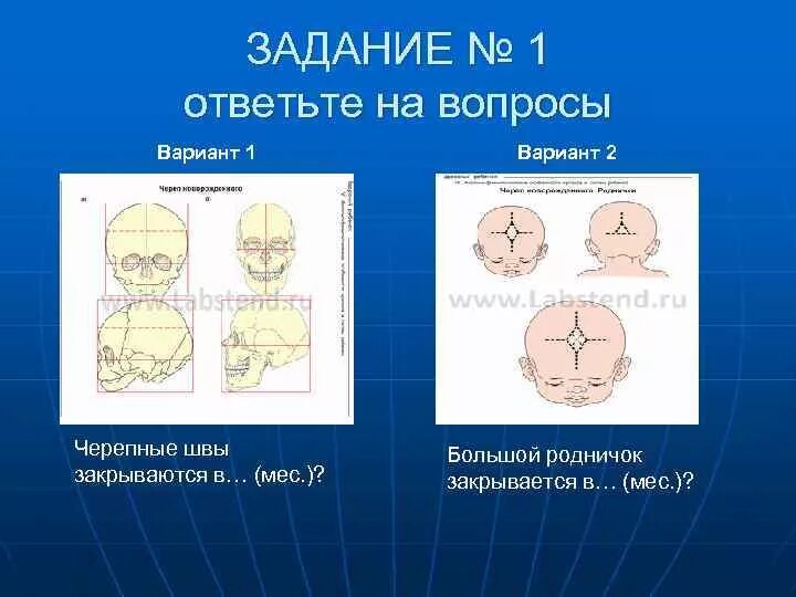 Родничок у детей когда закрывается норма. Измерение большого родничка. измерение родничка у новорожденного. измерение размеров родничка у детей. размер большого родничка у новорожденного.