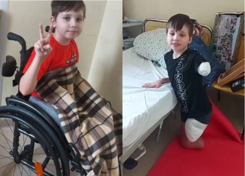 Влад СИНИЛКИН. Мальчик инвалид. Мальчик инвалид без рук и ног
