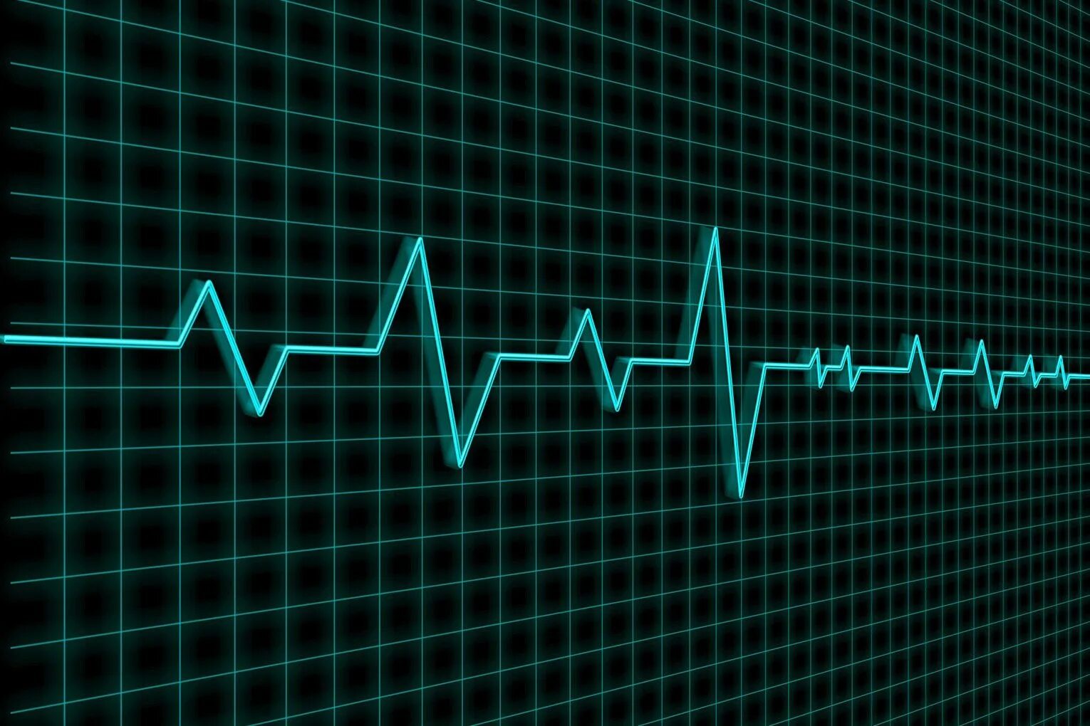 Чсс после сна. Пульс графика. Пульс 55. Пульс 55. Оценка частоты сердечных сокращений.