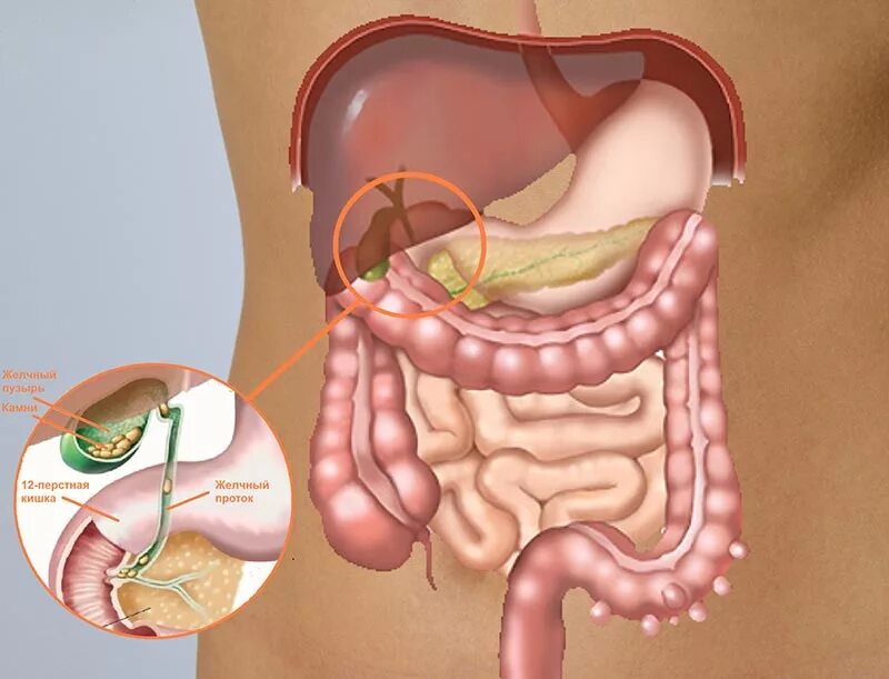 Кишечник желчный пузырь печень. Расположение желудка и кишечника. Переполненный кишечник.