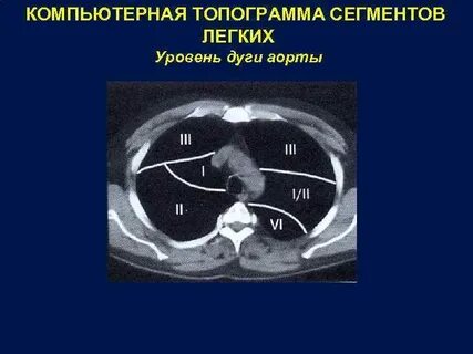 Топограмма