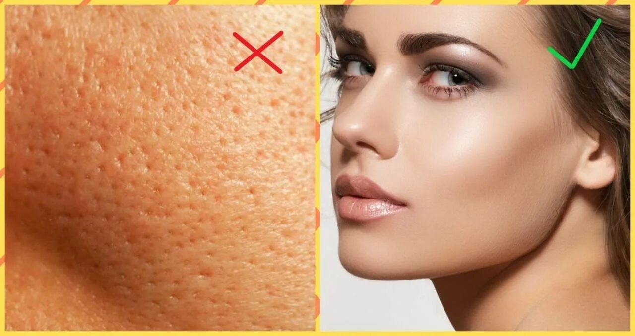 Строение кожи 3 слоя. Строение поры клетки. Строение волоса и волосяного фолликула. Строение порового комплекса ядерной поры. Где находятся поры.