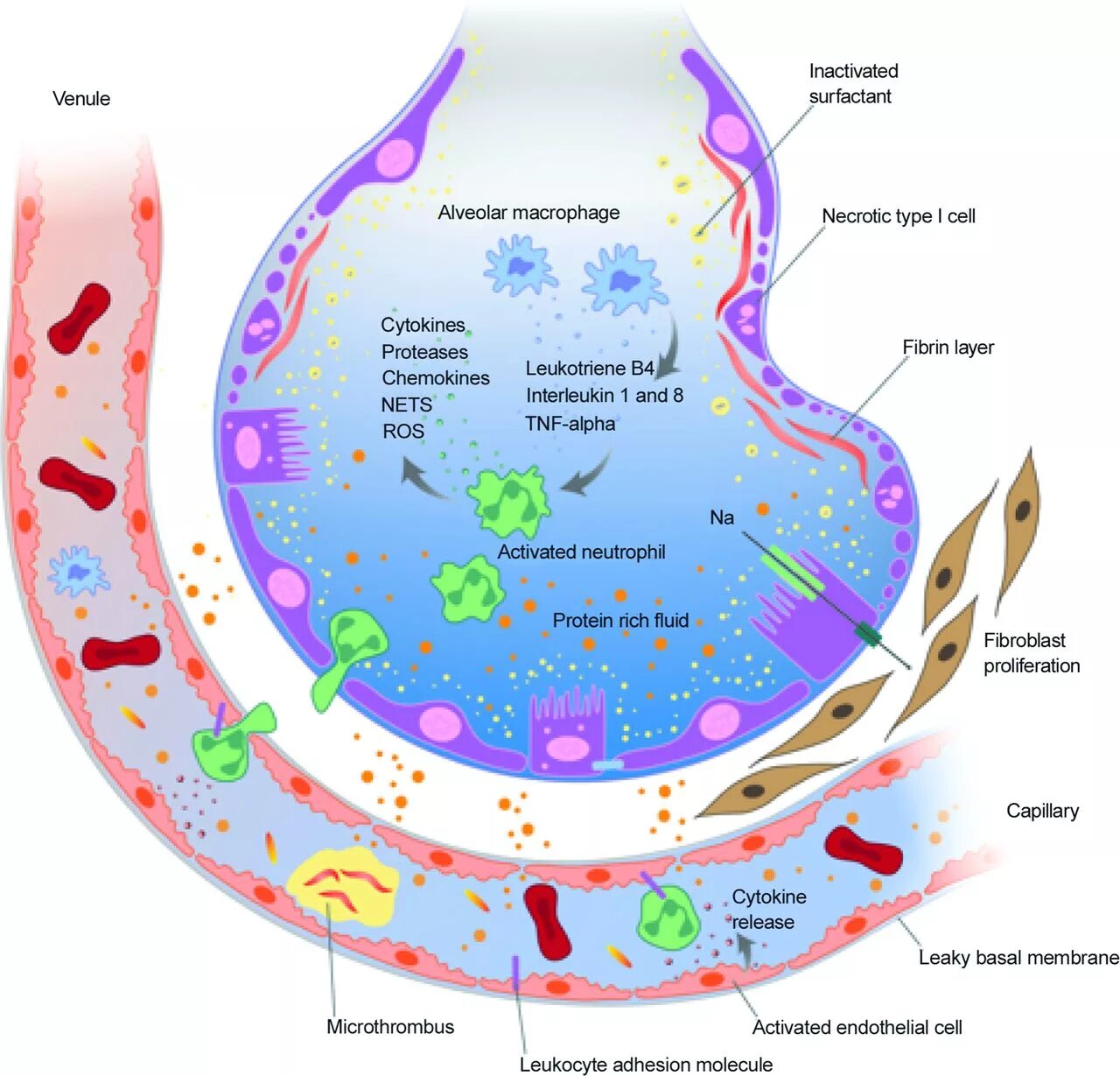 Art fact soft surfactant complex