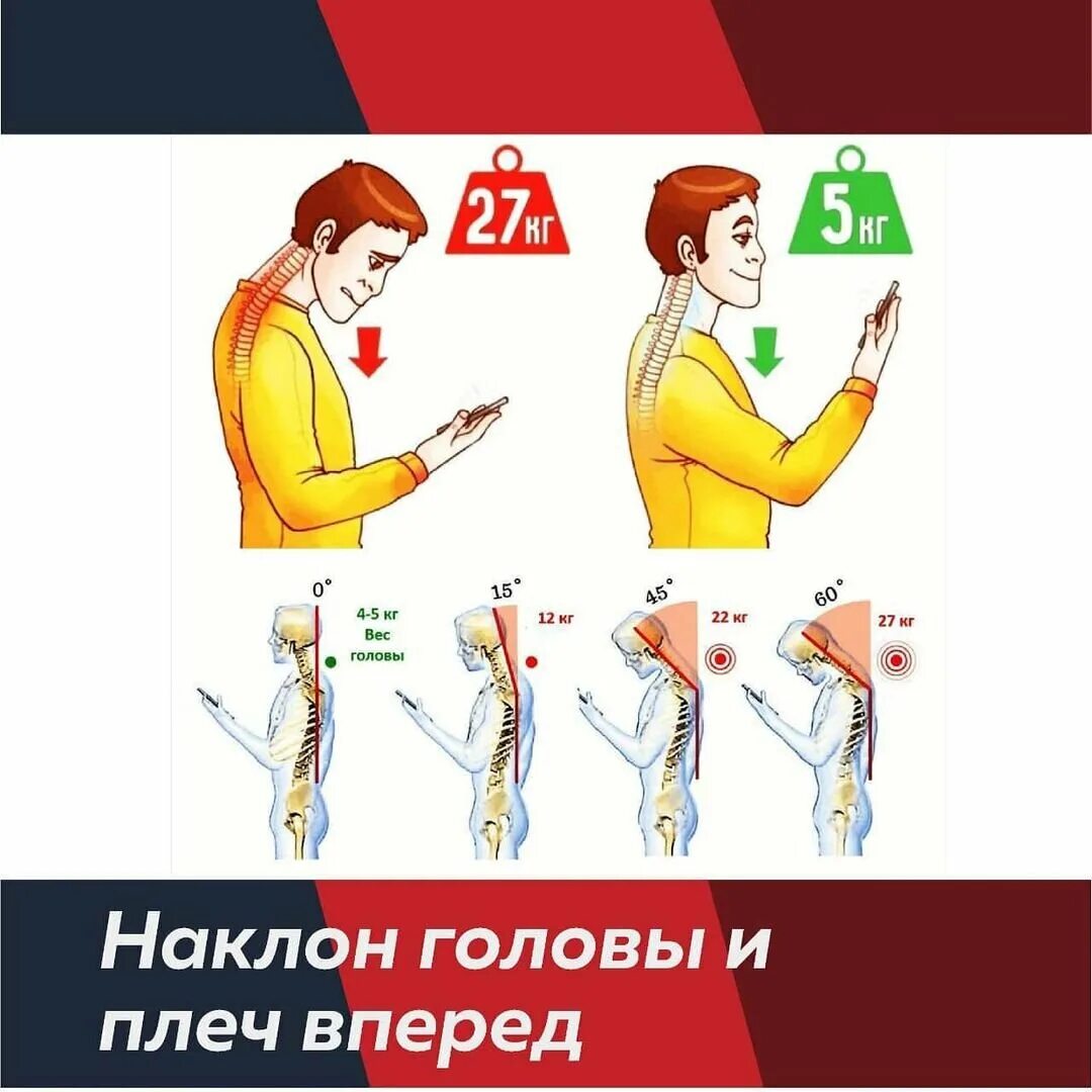 Sms шея