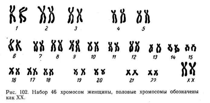 Нормальный набор хромосом человека таблица. Кариотип человека 46 хромосом. Кариотип 46 хромосом женщины. Кариотип человека женский и мужской.