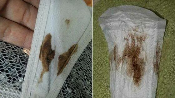 Мажет несколько дней