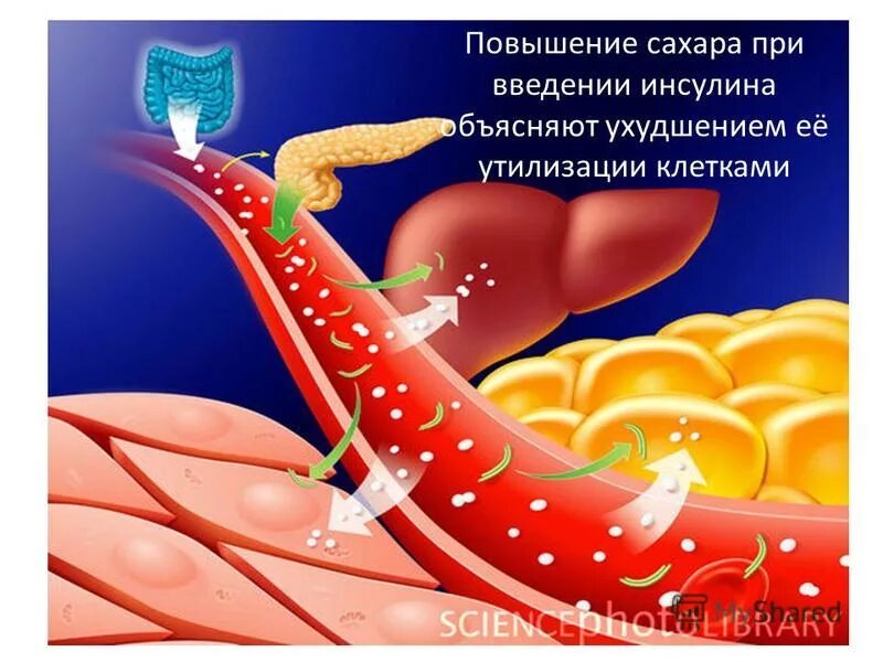 При повышении глюкозы в крови инсулин