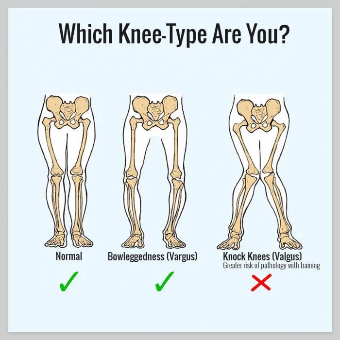 Pokemon what is it. хипстерские рисунки. Adjective noun phrases. What pokemon. Type are.