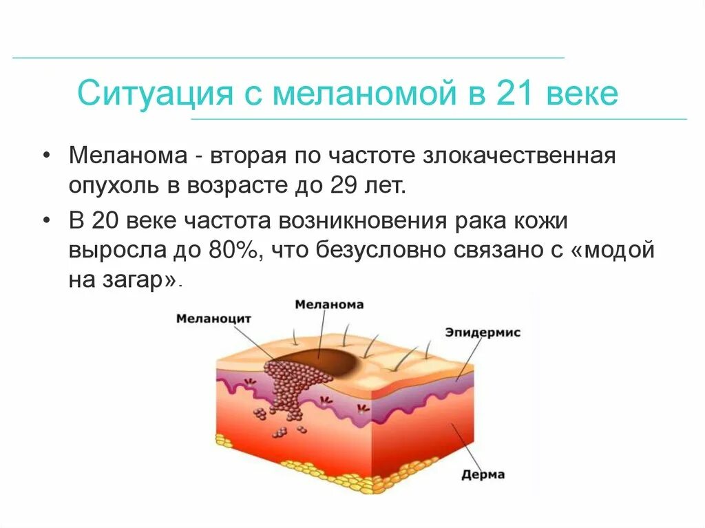 Уровень инвазии по кларку. Уровень инвазии по кларку