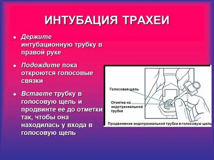 Интубация трахеи
