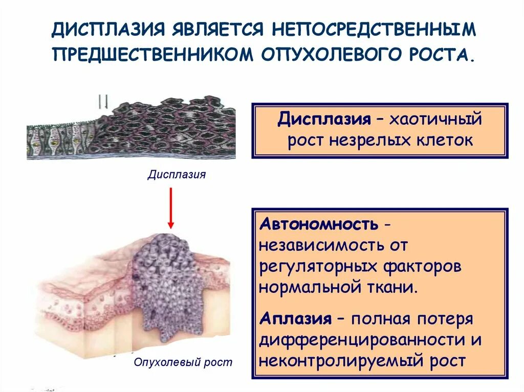 Лентигинозная меланоцитарная дисплазия. Дисплазия клеток это. Дисплазия клеток это. Дисплазия клеток это. Степени дисплазии клетки.