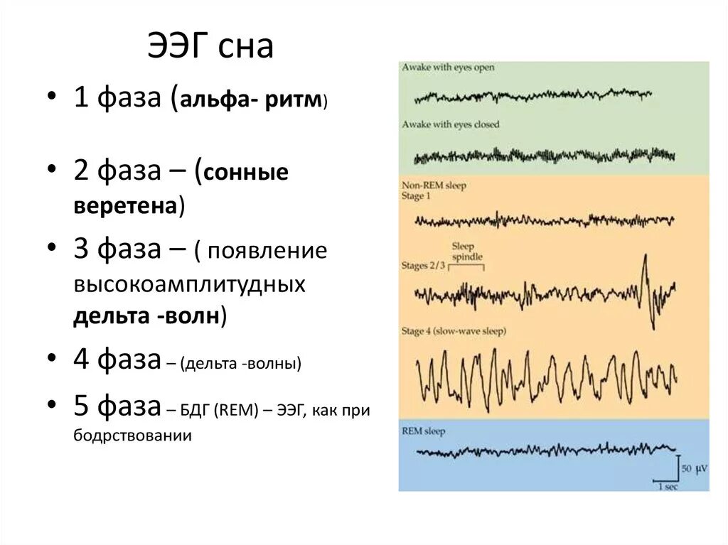 Фазы сна показатели ЭЭГ. ЭЭГ-корреляты фаз сна.. Стадии сна на ЭЭГ. Сонные веретена и к-комплексы на ЭЭГ.