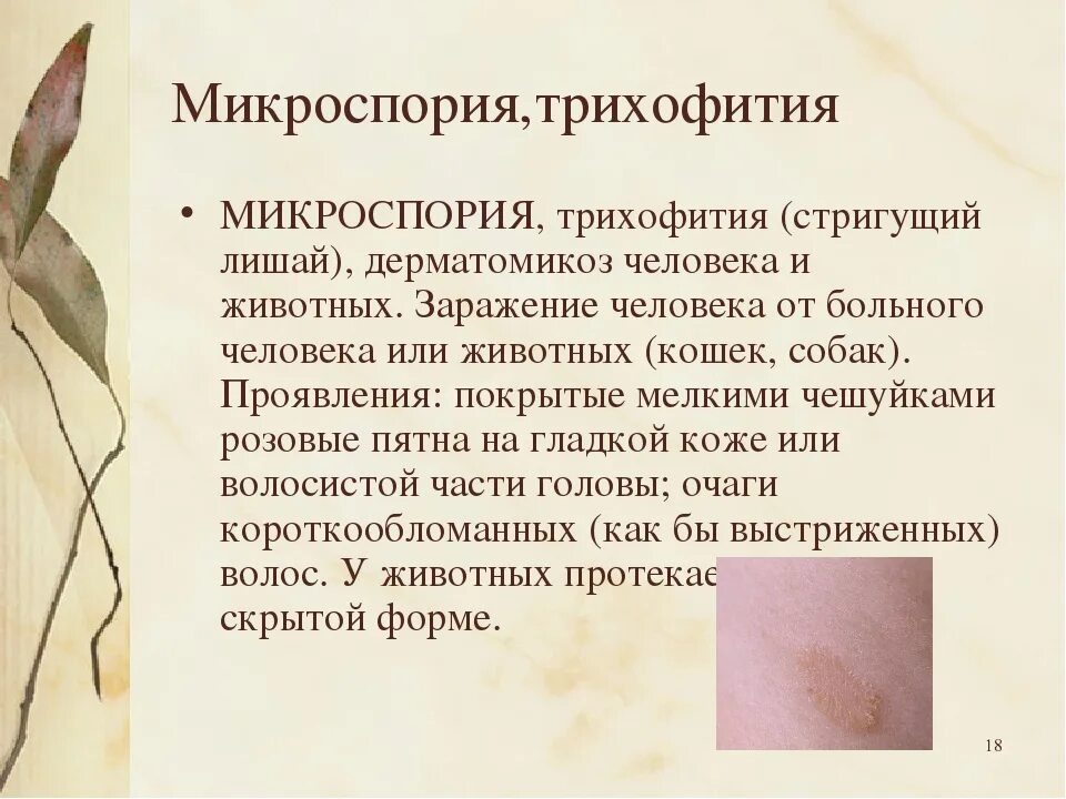 Трихофития инфекционное заболевание. Микроспоория гладкой кожа. Микроспория гладкой кожи.