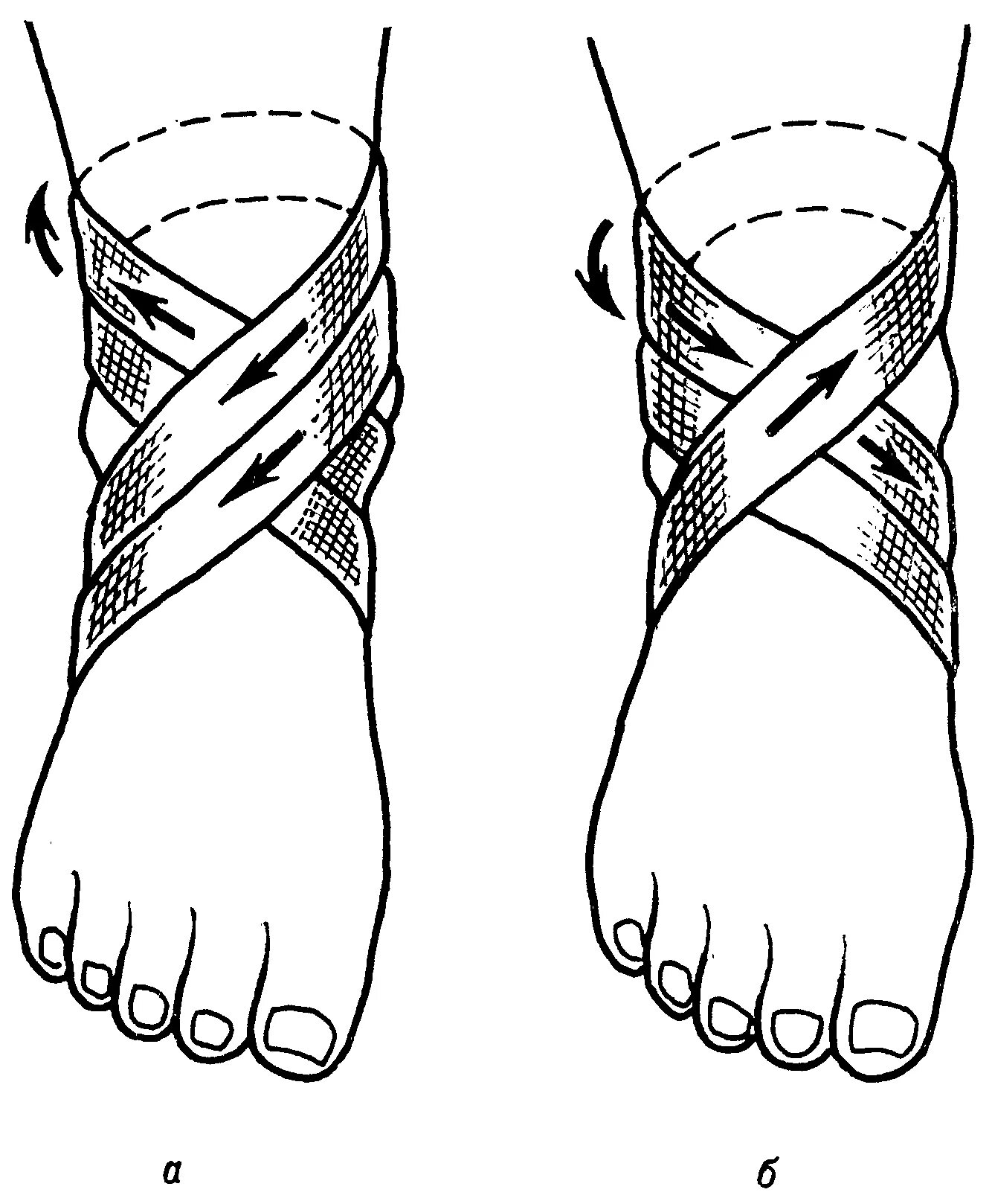 Восьмиобразная повязка на голеностопный сустав. Крестообразная (восьмиобразная) повязка. Бинтование голеностопа восьмеркой. Восьмиобразная повязка на голеностоп техника.