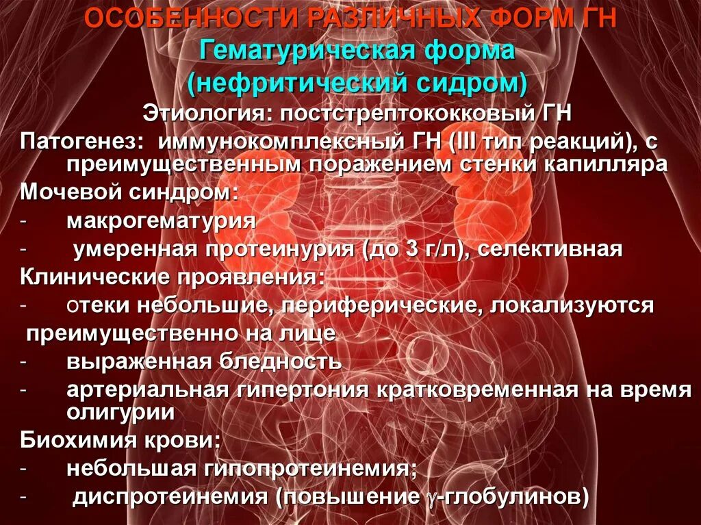 Острый гломерулонефрит нефротический синдром. Гематурическая форма хронического гломерулонефрита. Острый гломерулонефрит гематурическая форма. Хронический гломерулонефрит этиология. Гломерулонефрит у детей презентация.