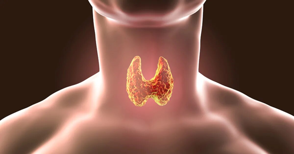 Токсическая аденома щитовидной железы. 25 Мая день щитовидной железы 2022. Здоровая щитовидная железа.