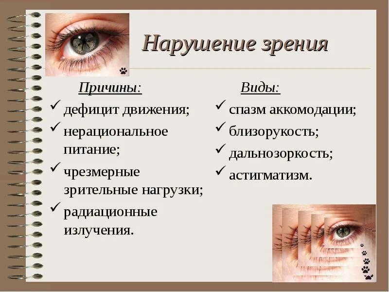 Варианты нарушения зрения. Нарушение зрения. виды нарушения зрения. виды ухудшения зрения. факторы нарушения зрения.