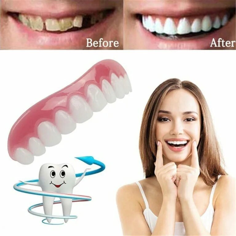 Виниры perfect smile Veneers. Perfect smile Veneers накладные виниры. Виниры комплект Snap-on smile. Съемные виниры perfect smile Veneers.