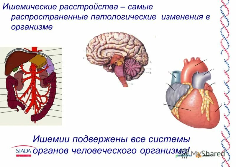 Хроническая артериальная ишемия