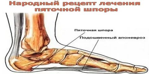 Пяточная область лечение