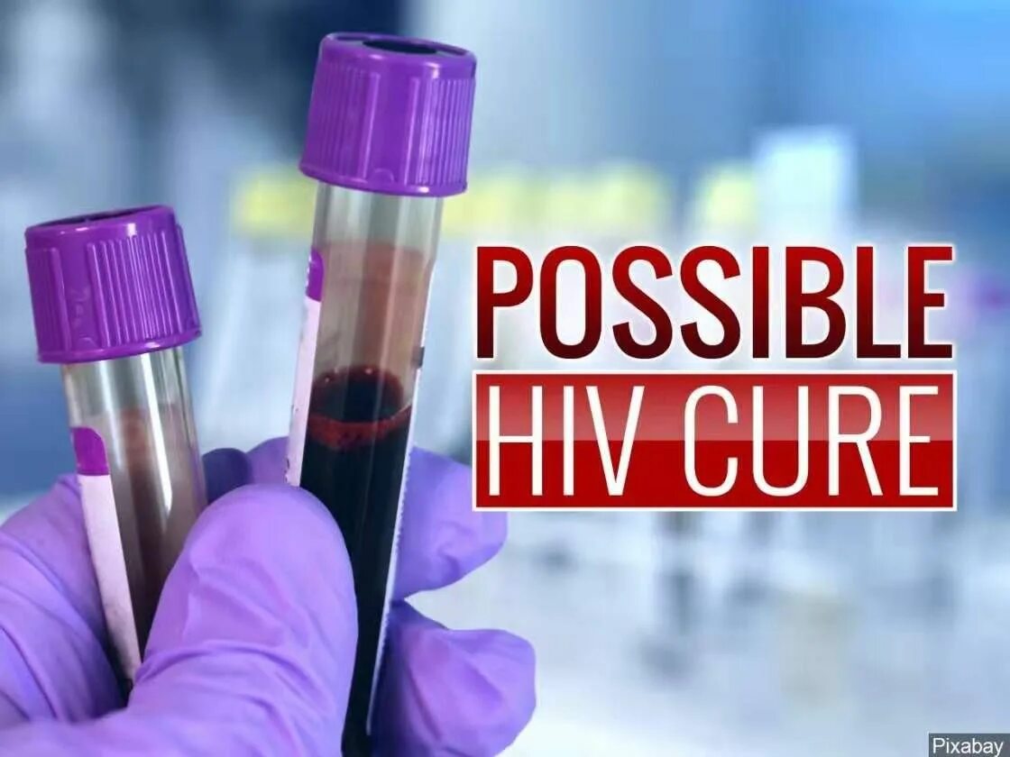 Hiv cure news. Hiv cure news. Hiv cure news. Hiv cure news. Молодежь и спид.
