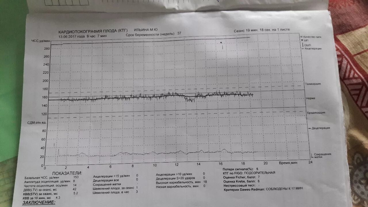 Исследование сердцебиения плода. КТГ при схватках показатели. Нормальная диаграмма КТГ. Хорошее КТГ плода. Схватки на КТГ.